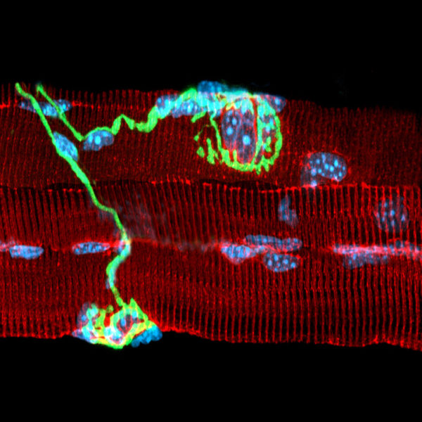 Inmg INMG - Institut NeuroMyoGène